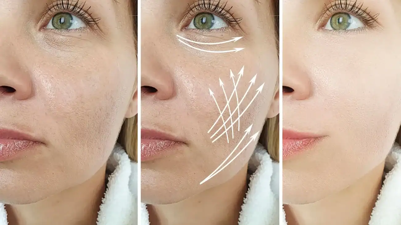 Can One Treatment Really Tackle More Than One Skin Concern Great Missenden?