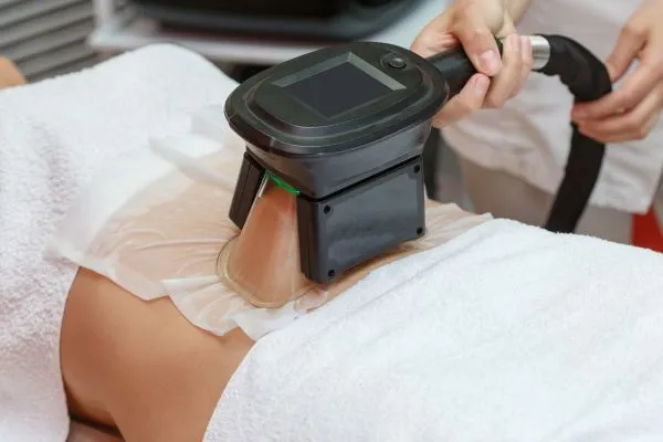 Image of person having fat freezing treatment to help weight gain Great Missenden