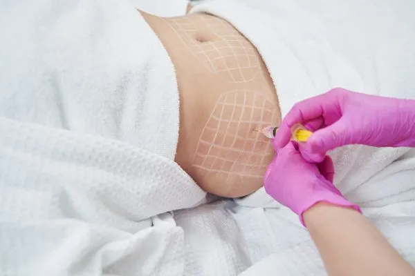 image of fat dissolving injections on love handles to help combat weight gain Great Missenden