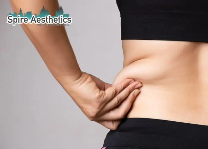 Image of woman pinching fat on their hips Great Missenden. Fat Freezing treatment