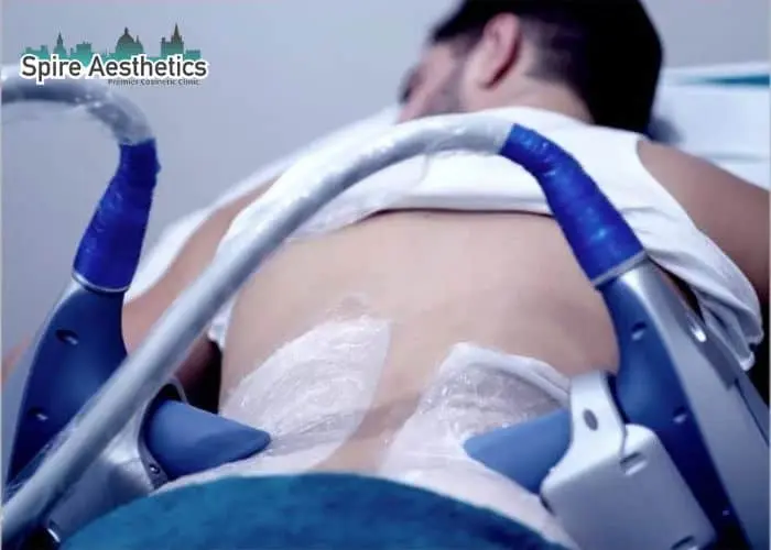 Man having fat freezing treatment done on love handles before a competitions Great Missenden to create a sculpted look.