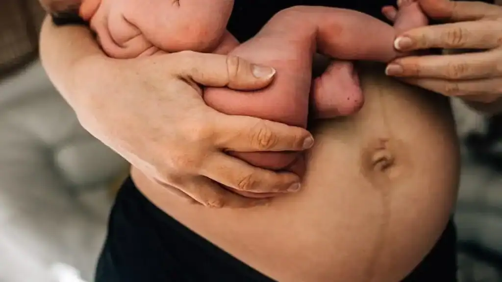 Why Is My Stomach Still Big After Pregnancy Great Missenden?