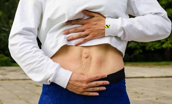 When Could Diastasis Recti Be the Missing Piece of the Puzzle Great Missenden?